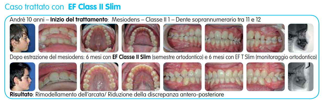 EF Classe II Slim immagine testo