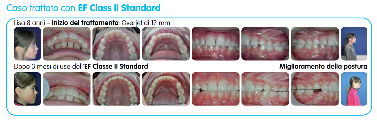 EF Classe II Standard immagine testo