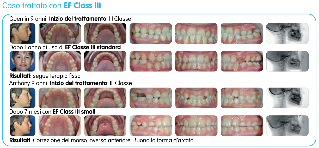 EF Classe III immagine testo