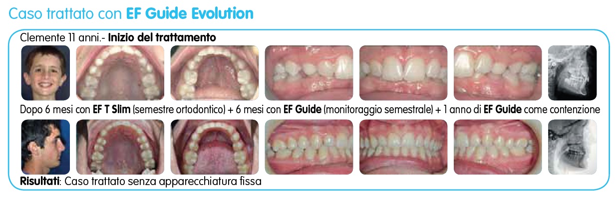 EF Guide Evolution immagine testo