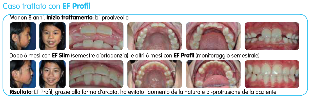 EF Profil immagine testo