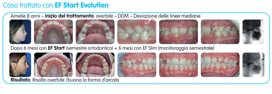 EF Start Evolution immagine testo