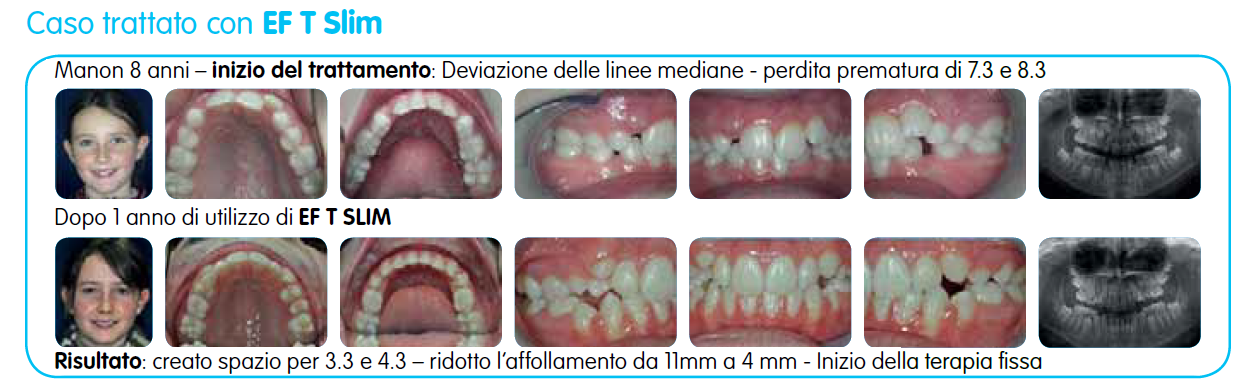 EF T Slim immagine testo