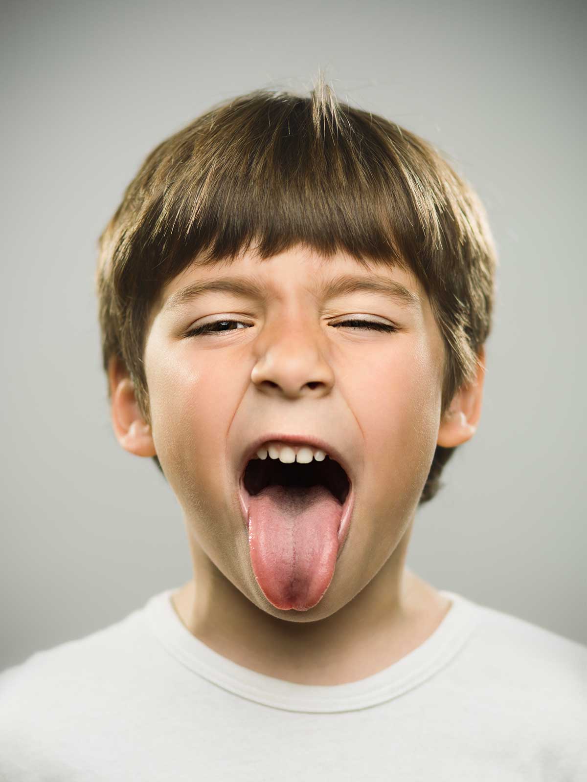 La lingua, l’organo responsabile della crescita oro-dentale