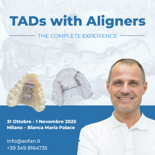TADs with Aligners | The Complete Experience – Dr. Alessandro Greco