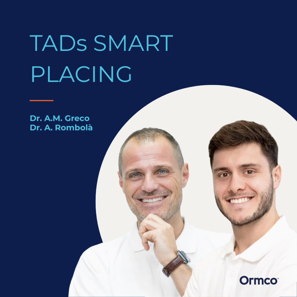 TADs SMART PLACING